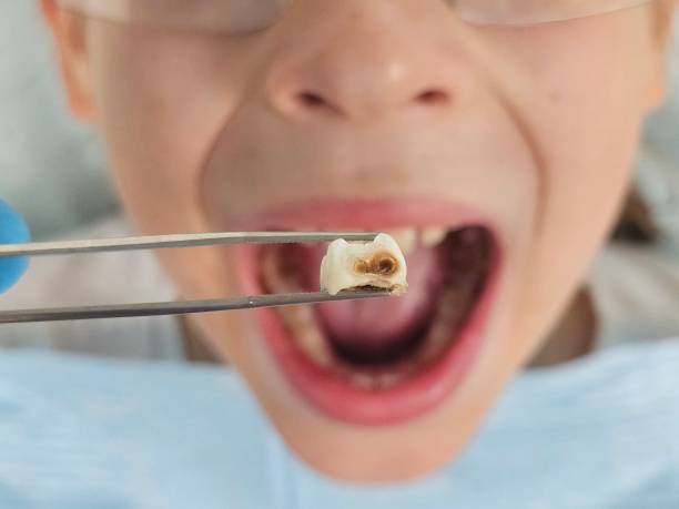Best Walk-In Emergency Dentist in East Wenatchee, WA
